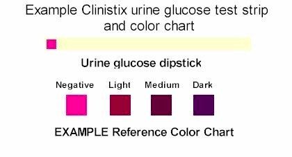 color chart for urine dip